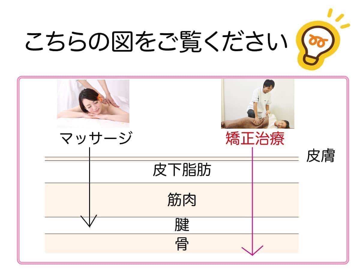 骨盤矯正とは