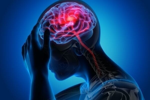 注意が必要な頭痛